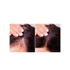 ANTI HAIR LOSS