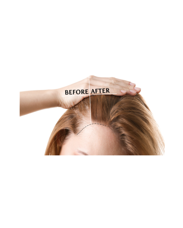 ANTI HAIR LOSS