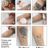 CORRECTOR LIGHT